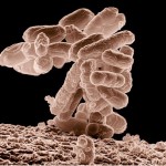 A cluster of Escherichia coli (E. coli) bacteria magnified 10,000 times that is generally found in the intestines.