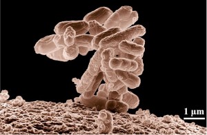 A cluster of Escherichia coli (E. coli) bacteria magnified 10,000 times that is generally found in the intestines.